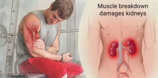 SY Performance Monthly Muscle Flex – Know the Warning Signs of Rhabdomyolysis